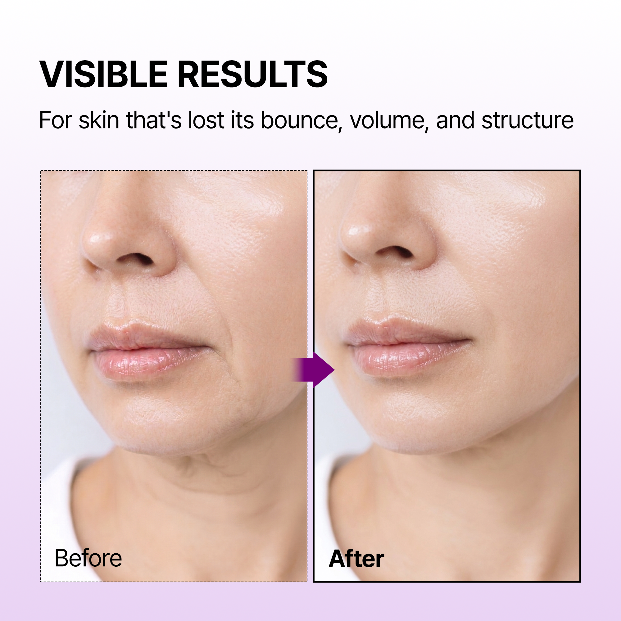 Calcium Bonding Serum & Cream Duo - image 4