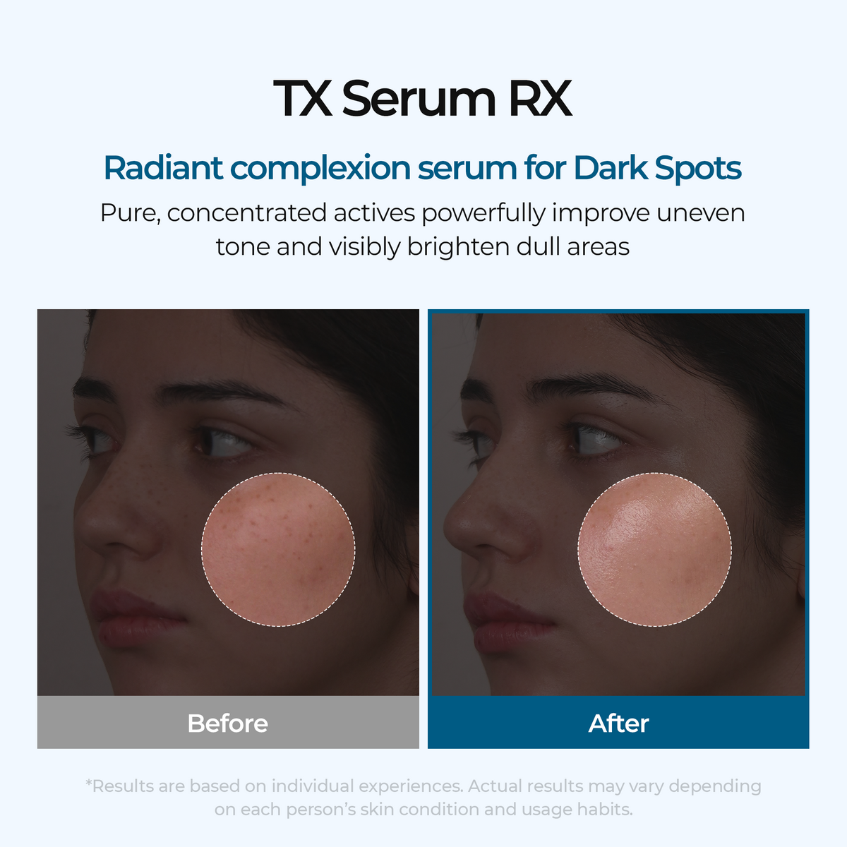 TX Ampoule Rx - image 2