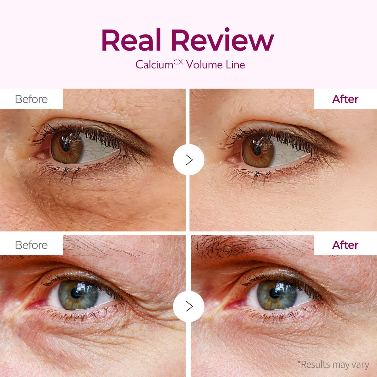 Calcium Volume Eye patch 60ea - image 3