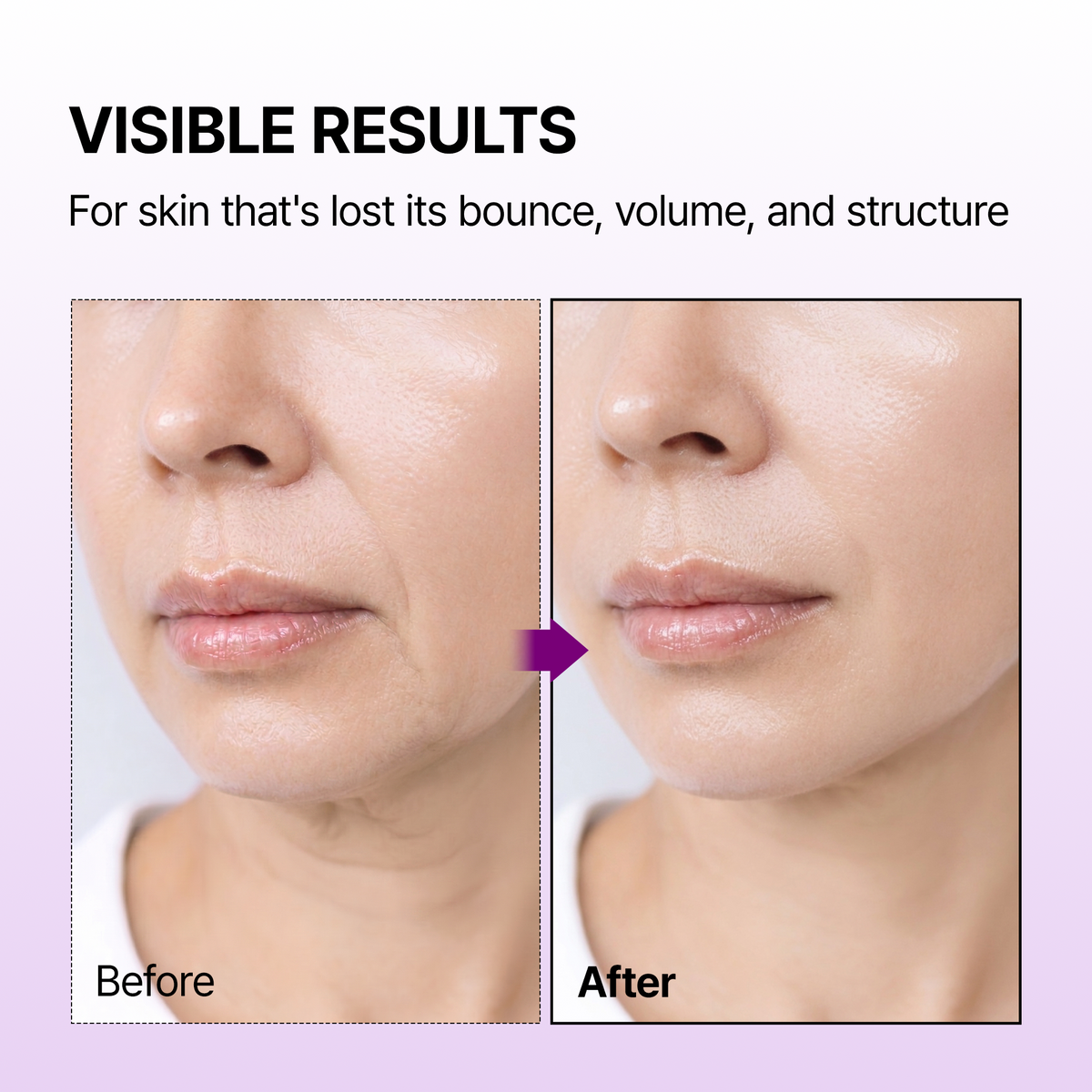 Calcium Bonding Serum - image 3
