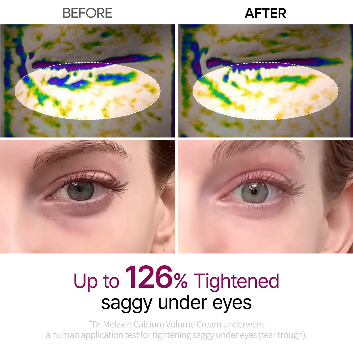 Calcium Eye care Line - image 3