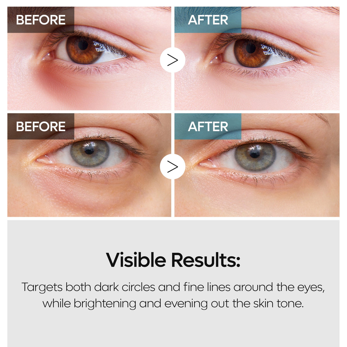 TX Retinalsome Eyecream 40g 1EA - image 5