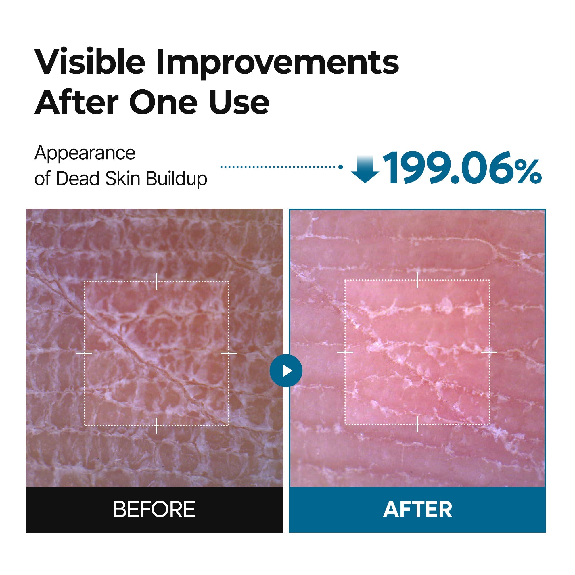 Peel Shot Exfoliating TX Spray - image 3